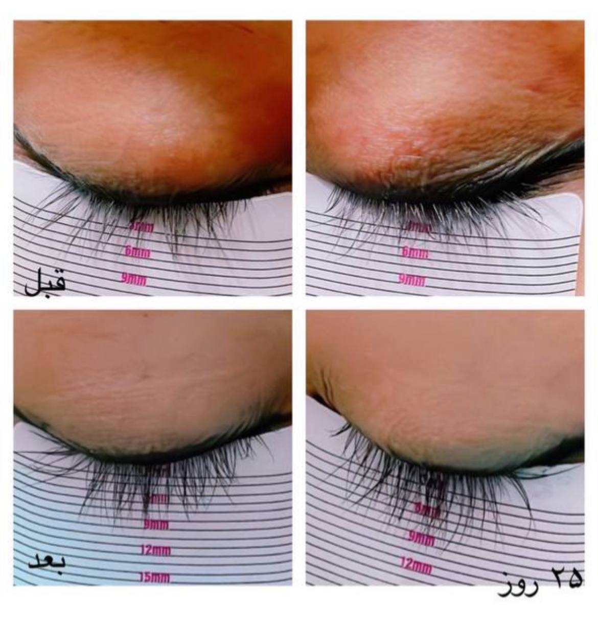 سرم تقویت مژه تراست